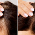 Hair Care Routine for Managing Female Hair Loss