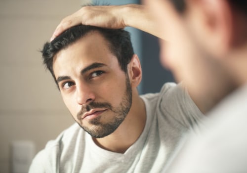 Lifestyle Changes for Preventing Male Pattern Baldness: A Comprehensive Guide